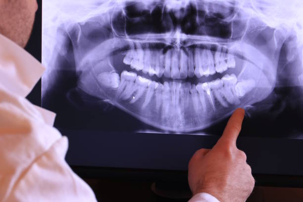 Best Cosmetic Emergency Dentistry in Chapel Hill, TN