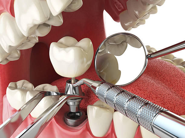 Best Emergency TMJ Treatment in Chapel Hill, TN